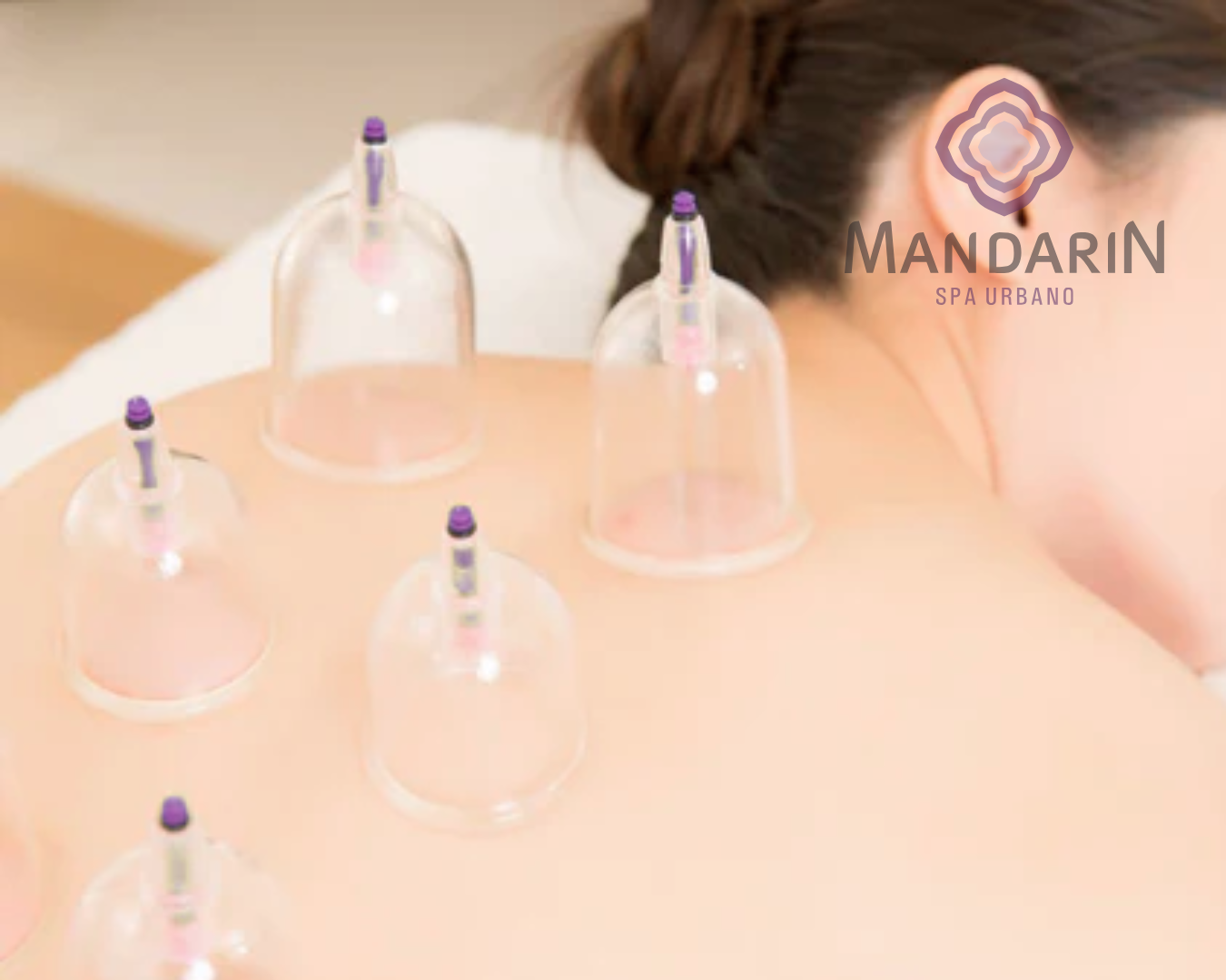 Ventosaterapia (30 min)