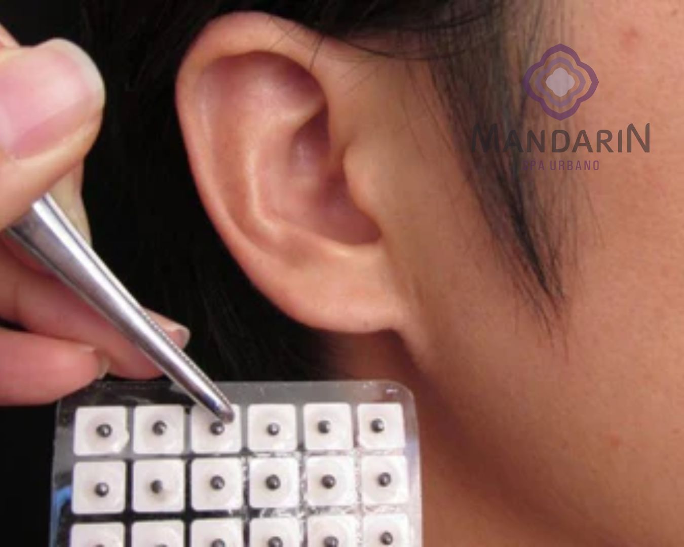 Auriculoterapia (30min)